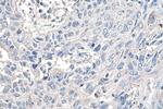 YTHDF1 Antibody in Immunohistochemistry (Paraffin) (IHC (P))