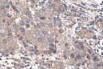 YTHDF1 Antibody in Immunohistochemistry (Paraffin) (IHC (P))