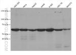 YTHDF1 Antibody in Western Blot (WB)