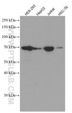 YTHDF1 Antibody in Western Blot (WB)