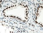 AR Antibody in Immunohistochemistry (Paraffin) (IHC (P))