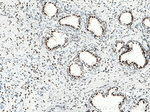 AR Antibody in Immunohistochemistry (Paraffin) (IHC (P))