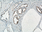 AR Antibody in Immunohistochemistry (Paraffin) (IHC (P))