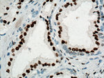 AR Antibody in Immunohistochemistry (Paraffin) (IHC (P))