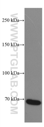 DR6 Antibody in Western Blot (WB)