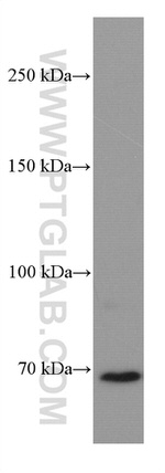 DR6 Antibody in Western Blot (WB)