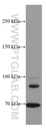 DR6 Antibody in Western Blot (WB)