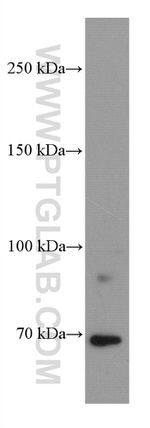 DR6 Antibody in Western Blot (WB)