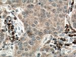 TRAF4 Antibody in Immunohistochemistry (Paraffin) (IHC (P))