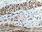 TRAF4 Antibody in Immunohistochemistry (Paraffin) (IHC (P))