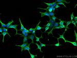 DKK3 Antibody in Immunocytochemistry (ICC/IF)