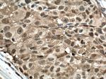 PSMB8 Antibody in Immunohistochemistry (Paraffin) (IHC (P))