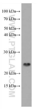 PSMB8 Antibody in Western Blot (WB)