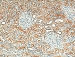 STX3 Antibody in Immunohistochemistry (Paraffin) (IHC (P))