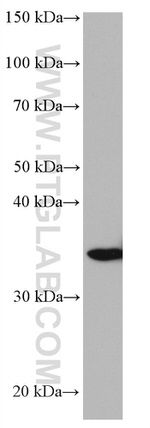 STX3 Antibody in Western Blot (WB)