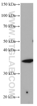 STX3 Antibody in Western Blot (WB)