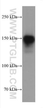 COL1A2 Antibody in Western Blot (WB)