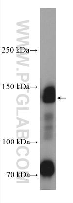 COL1A2 Antibody in Western Blot (WB)