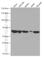 Catalase Antibody in Western Blot (WB)