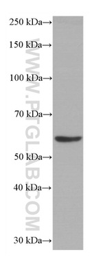 Catalase Antibody in Western Blot (WB)