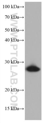 HSPB1 Antibody in Western Blot (WB)