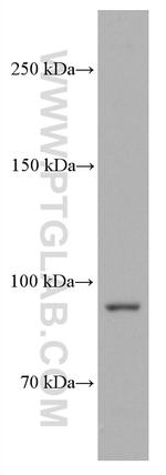 PYGL Antibody in Western Blot (WB)