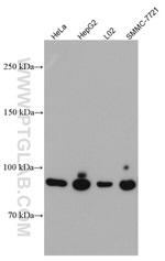 PYGL Antibody in Western Blot (WB)