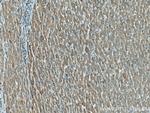 IFIH1 Antibody in Immunohistochemistry (Paraffin) (IHC (P))