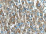 IFIH1 Antibody in Immunohistochemistry (Paraffin) (IHC (P))