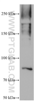 KCNQ2 Antibody in Western Blot (WB)