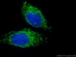 MFN1 Antibody in Immunocytochemistry (ICC/IF)