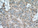 TOM20 Antibody in Immunohistochemistry (Paraffin) (IHC (P))