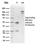 SPARC/Osteonectin Antibody in Immunoelectrophoresis (IE)