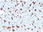 SPARC/Osteonectin Antibody in Immunohistochemistry (Paraffin) (IHC (P))