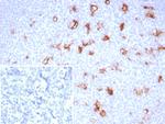 SPARC/Osteonectin Antibody in Immunohistochemistry (Paraffin) (IHC (P))