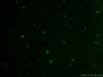 SOX10 Antibody in Immunohistochemistry (PFA fixed) (IHC (PFA))