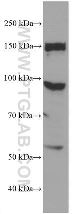 CFP Antibody in Western Blot (WB)