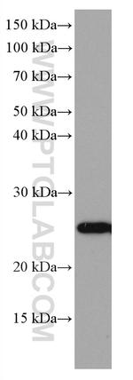 SOCS3 Antibody in Western Blot (WB)