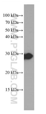 HPGD Antibody in Western Blot (WB)