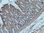 HPGD Antibody in Immunohistochemistry (Paraffin) (IHC (P))