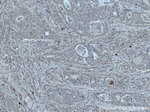 HPGD Antibody in Immunohistochemistry (Paraffin) (IHC (P))