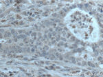 HPGD Antibody in Immunohistochemistry (Paraffin) (IHC (P))