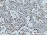 HPGD Antibody in Immunohistochemistry (Paraffin) (IHC (P))