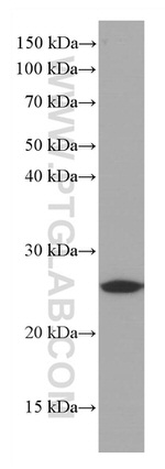 Bcl2 Antibody in Western Blot (WB)