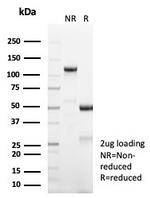 FOXL2 Antibody in SDS-PAGE (SDS-PAGE)