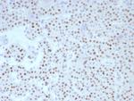 FOXL2 Antibody in Immunohistochemistry (Paraffin) (IHC (P))