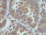 XIAP Antibody in Immunohistochemistry (Paraffin) (IHC (P))