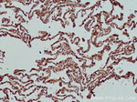 XIAP Antibody in Immunohistochemistry (Paraffin) (IHC (P))