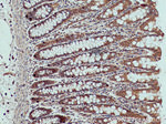 XIAP Antibody in Immunohistochemistry (Paraffin) (IHC (P))