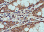 XIAP Antibody in Immunohistochemistry (Paraffin) (IHC (P))